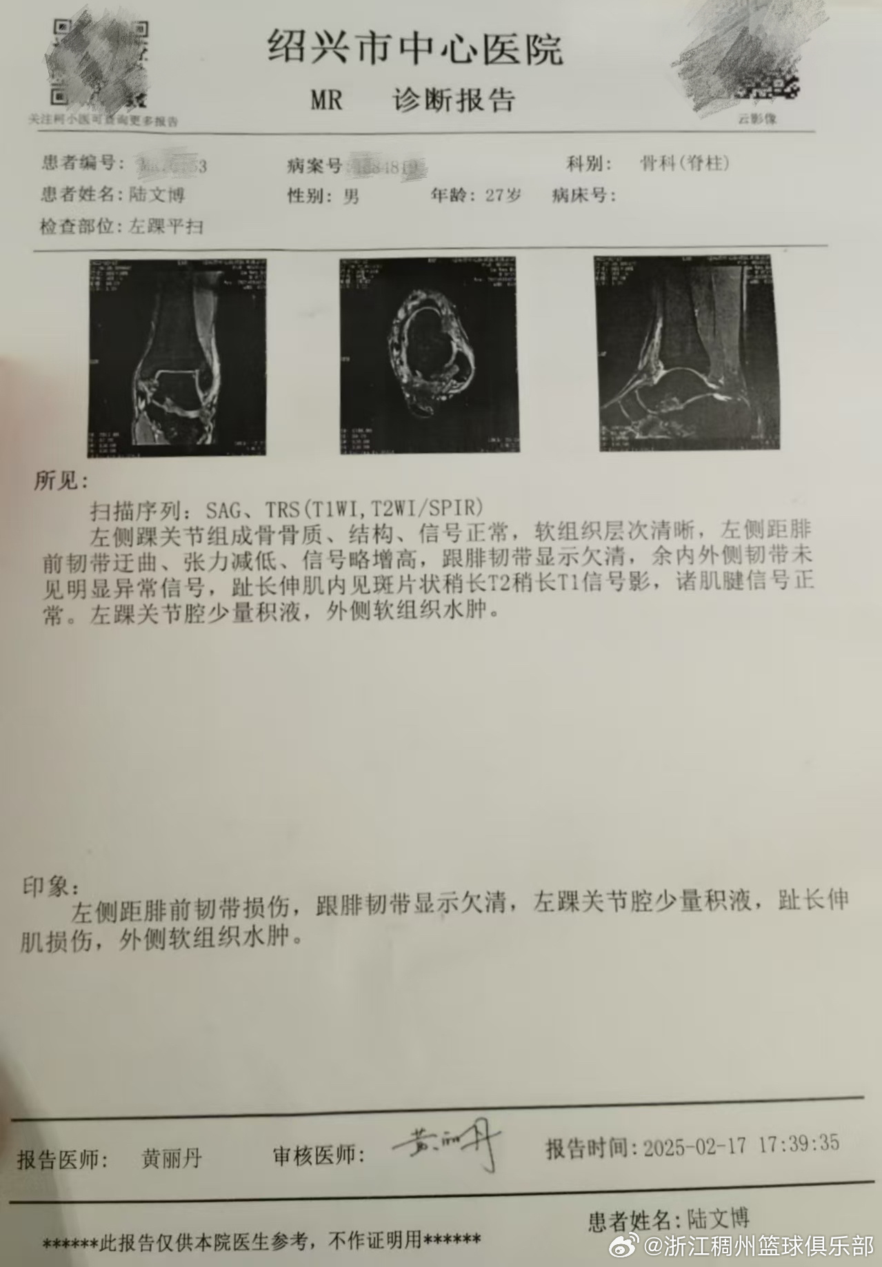 层次问题